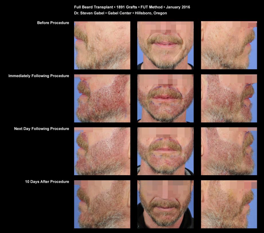 Click image for larger version

Name:	Beard-sheet.jpg

Size:	88.7 KB
ID:	44738