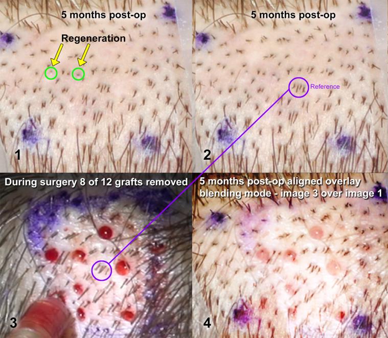 Click image for larger version

Name:	ACell study overlay-flat.jpg

Size:	94.4 KB
ID:	33484