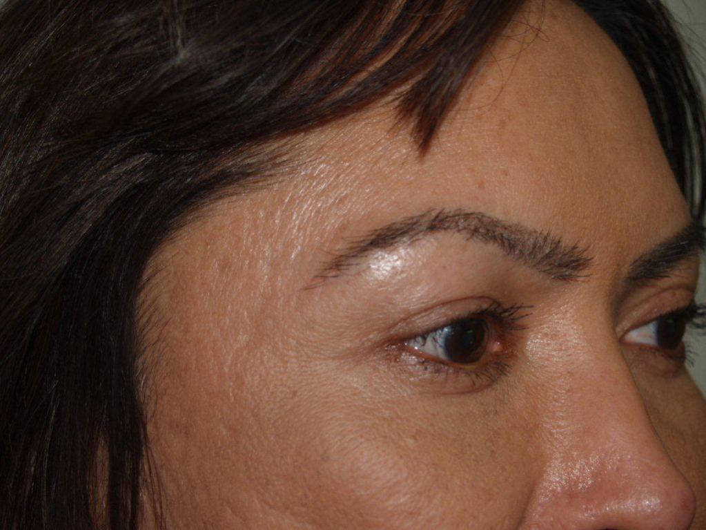 Click image for larger version

Name:	wnstnsalvdr aft eyebrows1.jpg

Size:	89.9 KB
ID:	4911