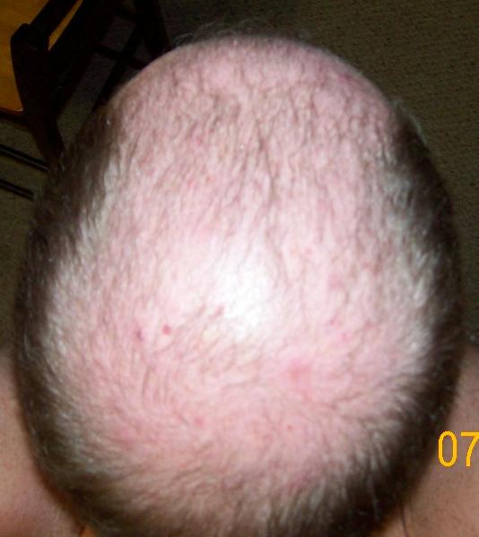 Click image for larger version

Name:	Back Head.jpg

Size:	32.0 KB
ID:	1963