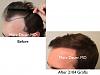 Click image for larger version

Name:	Hair Transplant Slides copy6.002.jpg

Size:	11.8 KB
ID:	43354