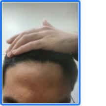 Click image for larger version

Name:	hairline.jpg

Size:	6.0 KB
ID:	72023