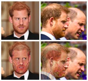 Click image for larger version

Name:	Hair loss in crown.jpg

Size:	18.7 KB
ID:	73778
