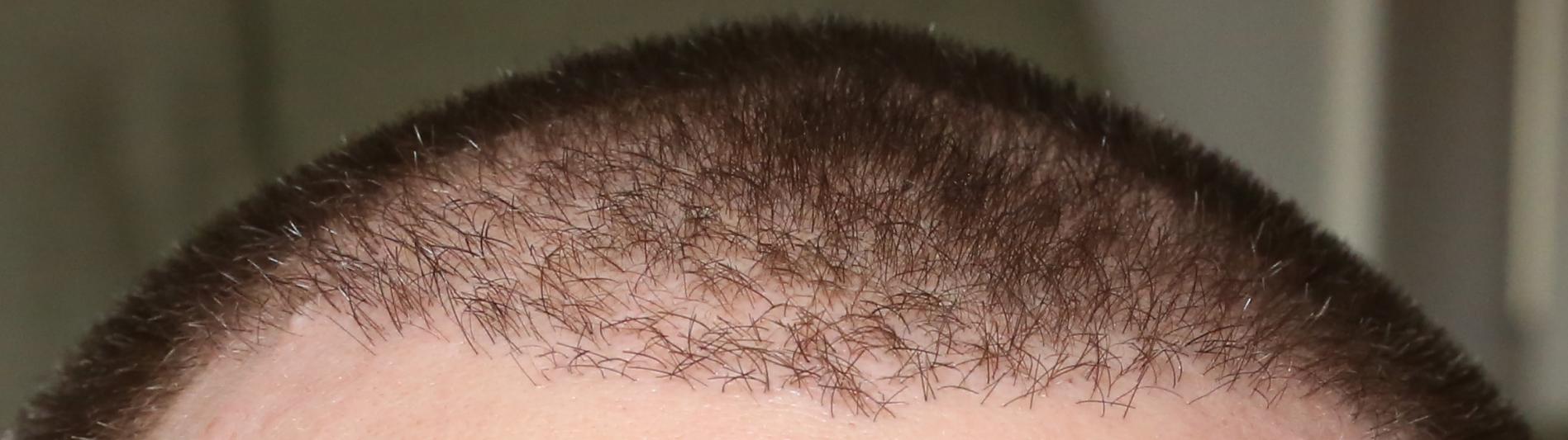 Click image for larger version

Name:	hairline.jpg

Size:	104.2 KB
ID:	37510