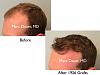 Click image for larger version

Name:	Hair Transplant Slides copy01.002.jpg

Size:	11.5 KB
ID:	48142