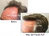 Click image for larger version

Name:	Hair Transplant Slides copy.004.jpg

Size:	15.2 KB
ID:	42824