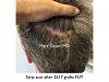 Click image for larger version

Name:	Hair Transplant Slides copy.006.jpg

Size:	19.0 KB
ID:	42827