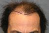 Click image for larger version

Name:	03_position-of-hairline.jpg

Size:	49.8 KB
ID:	13004