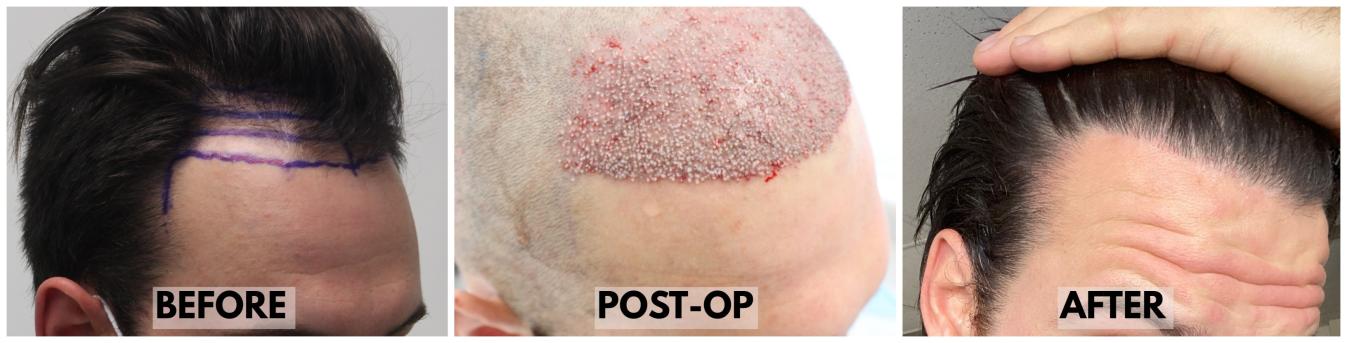 Click image for larger version

Name:	RightAngle-Forum.jpg
Views:	69
Size:	63.9 KB
ID:	534600