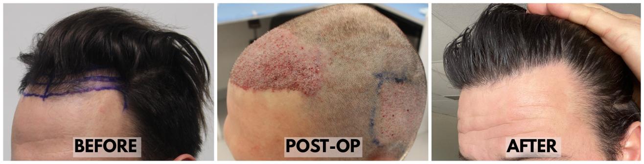 Click image for larger version

Name:	LeftAngle-Forum.jpg
Views:	68
Size:	62.6 KB
ID:	534601