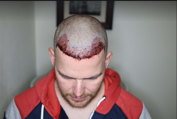 Click image for larger version  Name:	post op.jpg Views:	3 Size:	44.2 KB ID:	534879