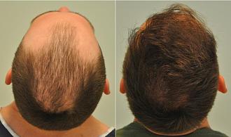 Click image for larger version

Name:	UZkettoskep77.jpg
Views:	140
Size:	39.3 KB
ID:	535128
