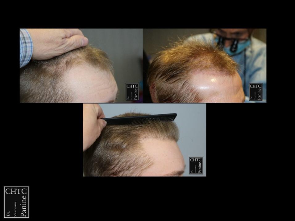 Click image for larger version

Name:	Slide2.jpg
Views:	77
Size:	47.8 KB
ID:	535891