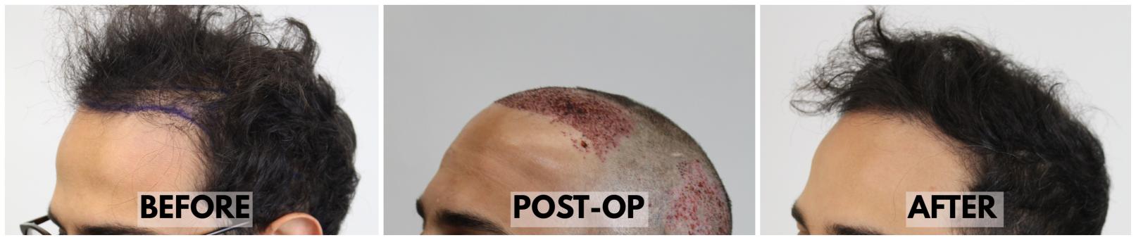 Click image for larger version

Name:	LeftAngle-Forum.jpg
Views:	173
Size:	58.3 KB
ID:	536183