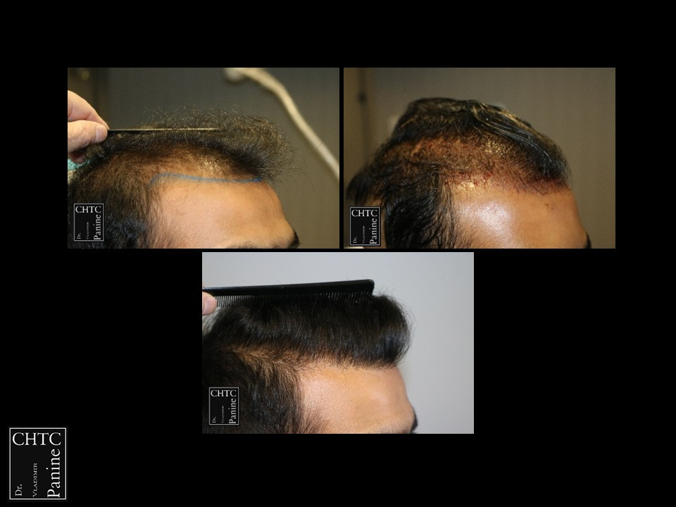 Click image for larger version

Name:	Slide4.jpg
Views:	5
Size:	93.4 KB
ID:	537583