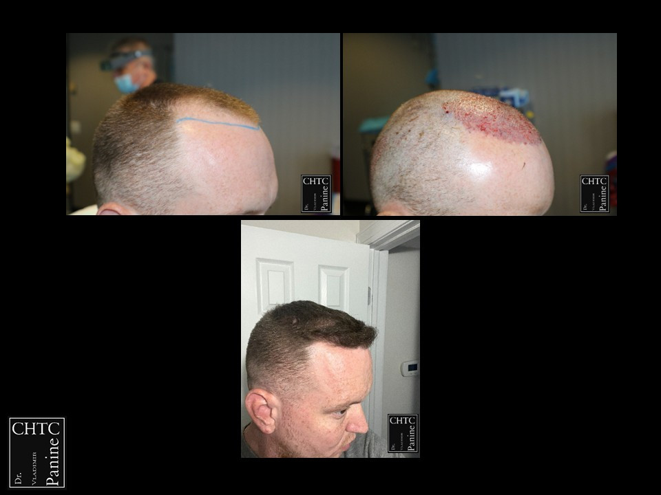 Click image for larger version

Name:	Slide3.jpg
Views:	0
Size:	85.7 KB
ID:	537876