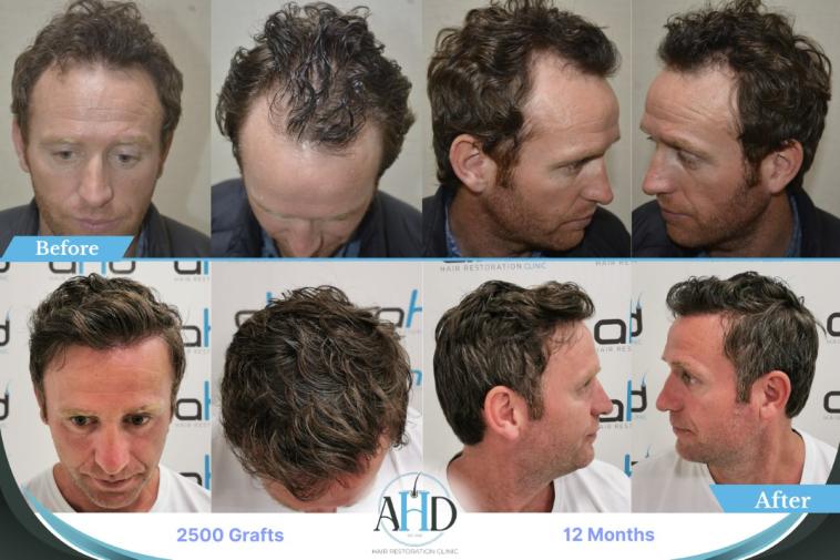 Click image for larger version

Name:	alan 1a.jpg
Views:	0
Size:	59.3 KB
ID:	538195