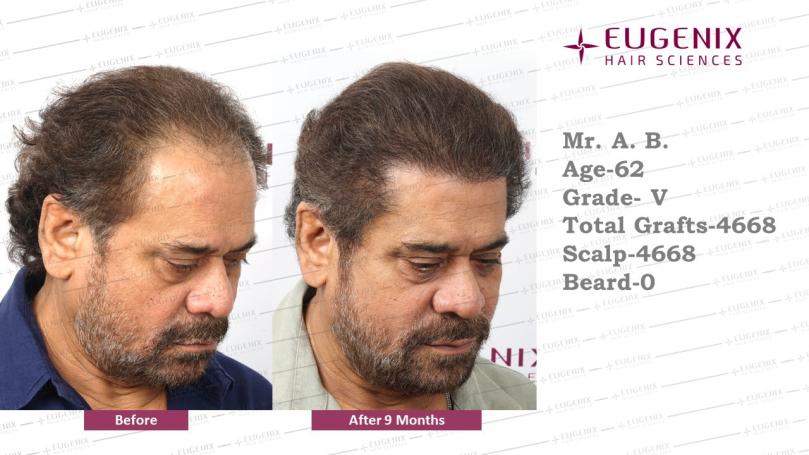 Click image for larger version

Name:	Slide1.jpg
Views:	18
Size:	53.4 KB
ID:	538317