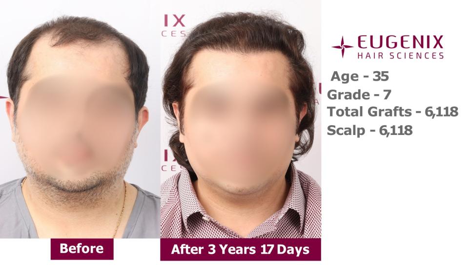 Click image for larger version

Name:	Slide 1.jpg
Views:	0
Size:	60.1 KB
ID:	538513