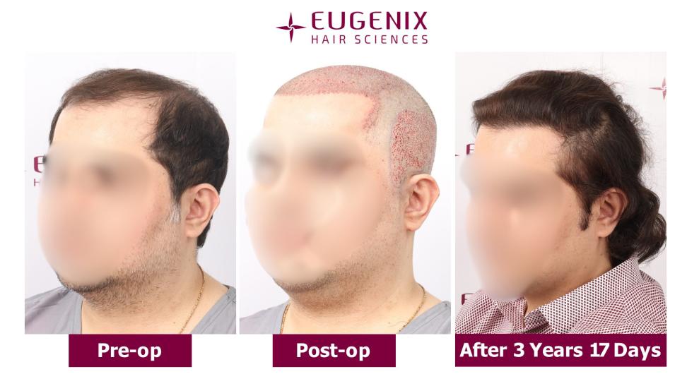 Click image for larger version

Name:	Slide5.jpg
Views:	0
Size:	57.5 KB
ID:	538518