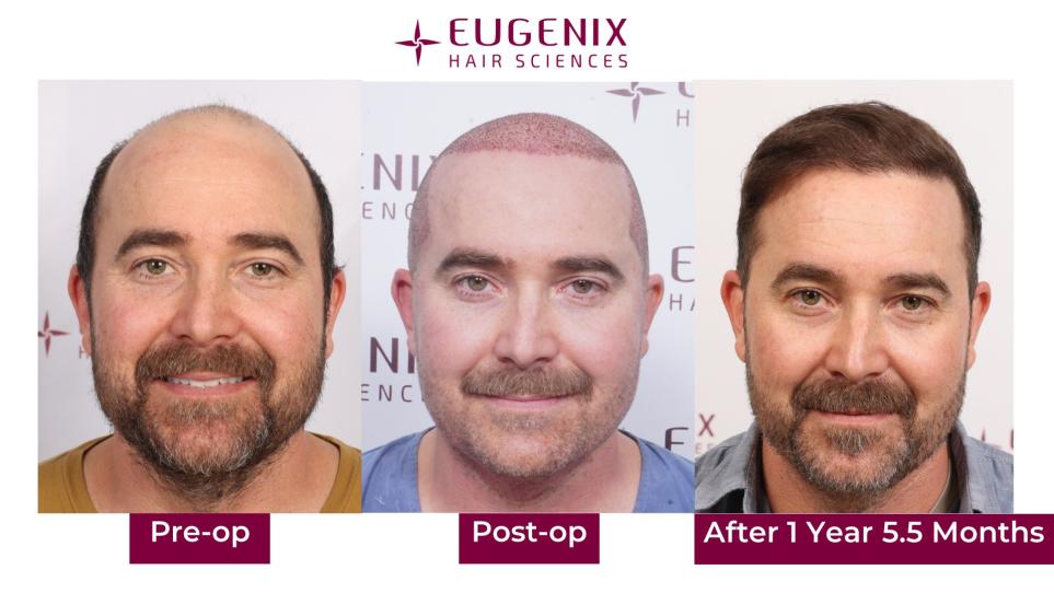 Click image for larger version  Name:	Slide2.jpg Views:	4 Size:	58.7 KB ID:	538826