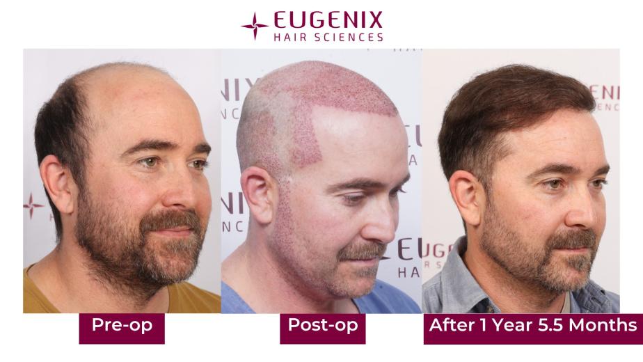 Click image for larger version  Name:	Slide4.jpg Views:	0 Size:	57.6 KB ID:	538828