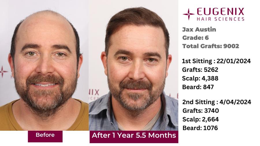 Click image for larger version  Name:	Slide 1.jpg Views:	0 Size:	62.4 KB ID:	538829