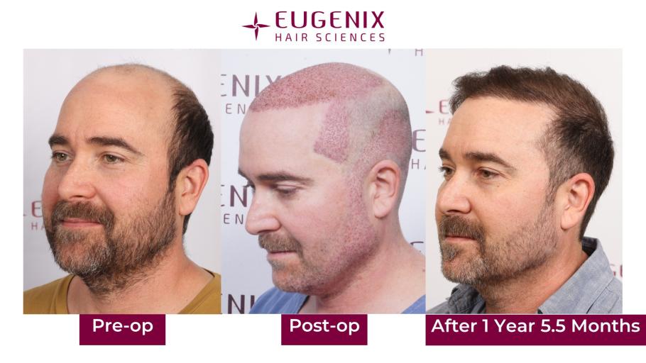 Click image for larger version  Name:	Slide5.jpg Views:	0 Size:	56.4 KB ID:	538830