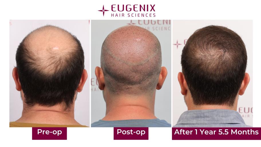 Click image for larger version  Name:	Slide6.jpg Views:	0 Size:	54.4 KB ID:	538831