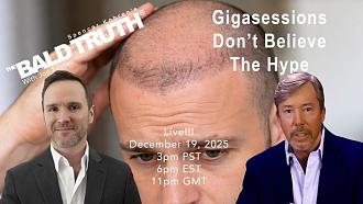 Click image for larger version

Name:	Gigasession Hair Transplants.jpg
Views:	4
Size:	61.9 KB
ID:	539043