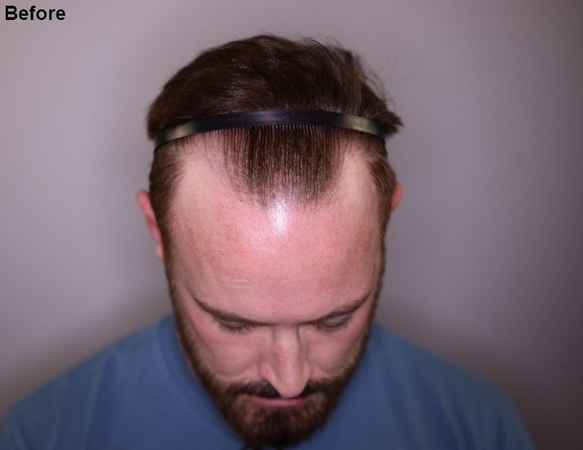 Click image for larger version

Name:	1.jpg
Views:	25
Size:	68.0 KB
ID:	539158