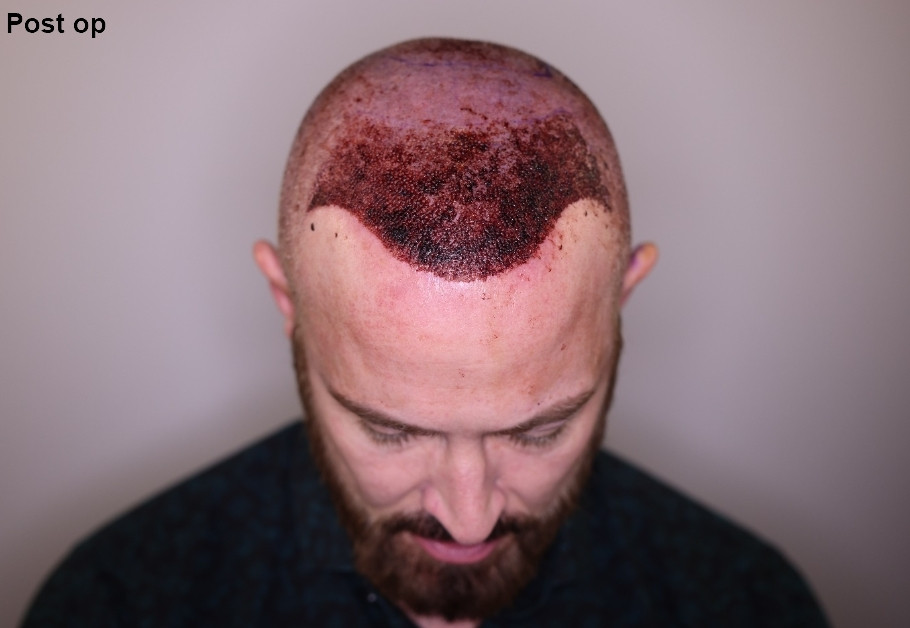 Click image for larger version

Name:	2.jpg
Views:	18
Size:	81.7 KB
ID:	539159