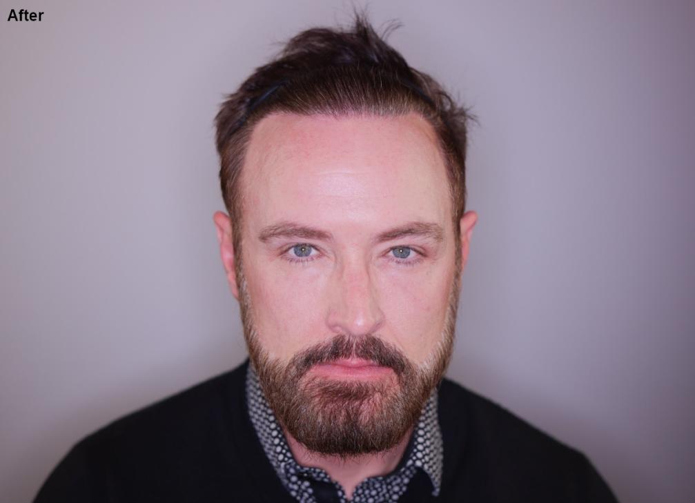 Click image for larger version

Name:	3.jpg
Views:	19
Size:	42.9 KB
ID:	539160