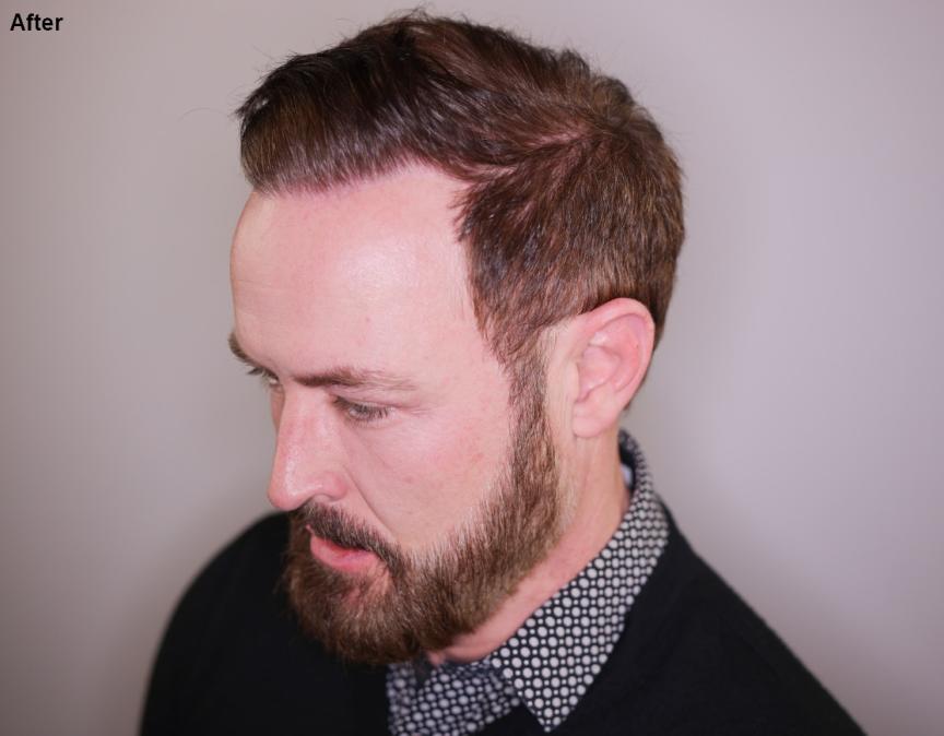 Click image for larger version

Name:	4.jpg
Views:	19
Size:	45.6 KB
ID:	539161