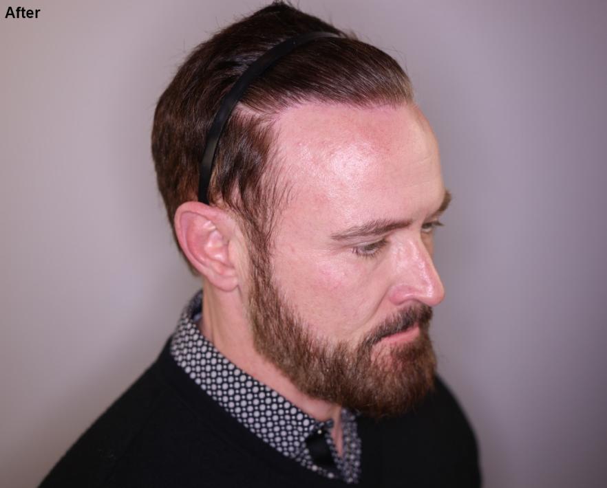 Click image for larger version

Name:	5.jpg
Views:	18
Size:	45.2 KB
ID:	539162