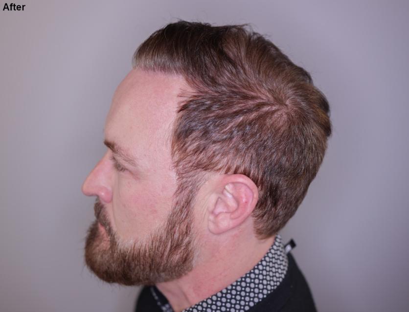 Click image for larger version

Name:	7.jpg
Views:	18
Size:	45.2 KB
ID:	539163