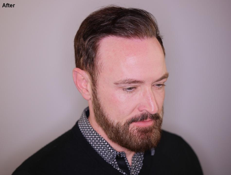 Click image for larger version

Name:	8.jpg
Views:	19
Size:	43.7 KB
ID:	539164