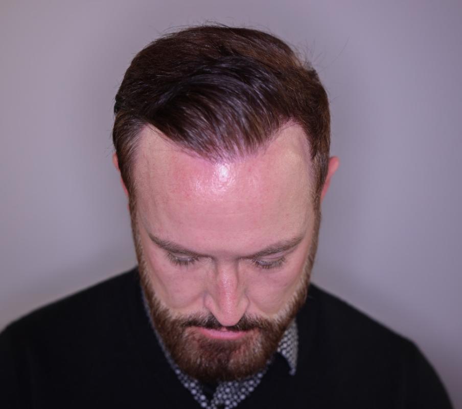 Click image for larger version

Name:	9.jpg
Views:	18
Size:	43.2 KB
ID:	539165