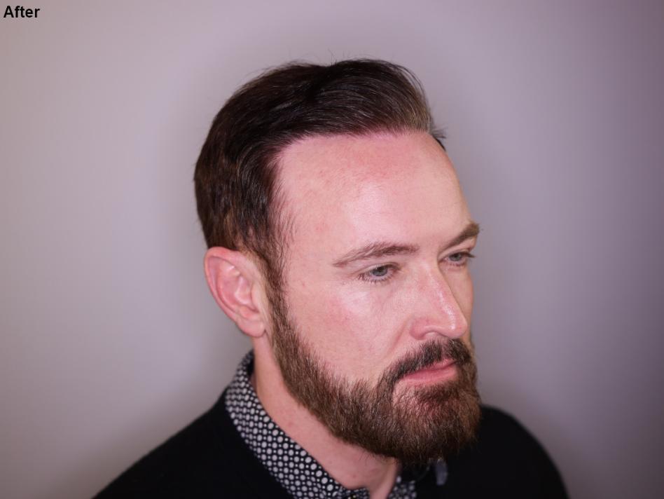 Click image for larger version

Name:	10.jpg
Views:	19
Size:	43.9 KB
ID:	539166