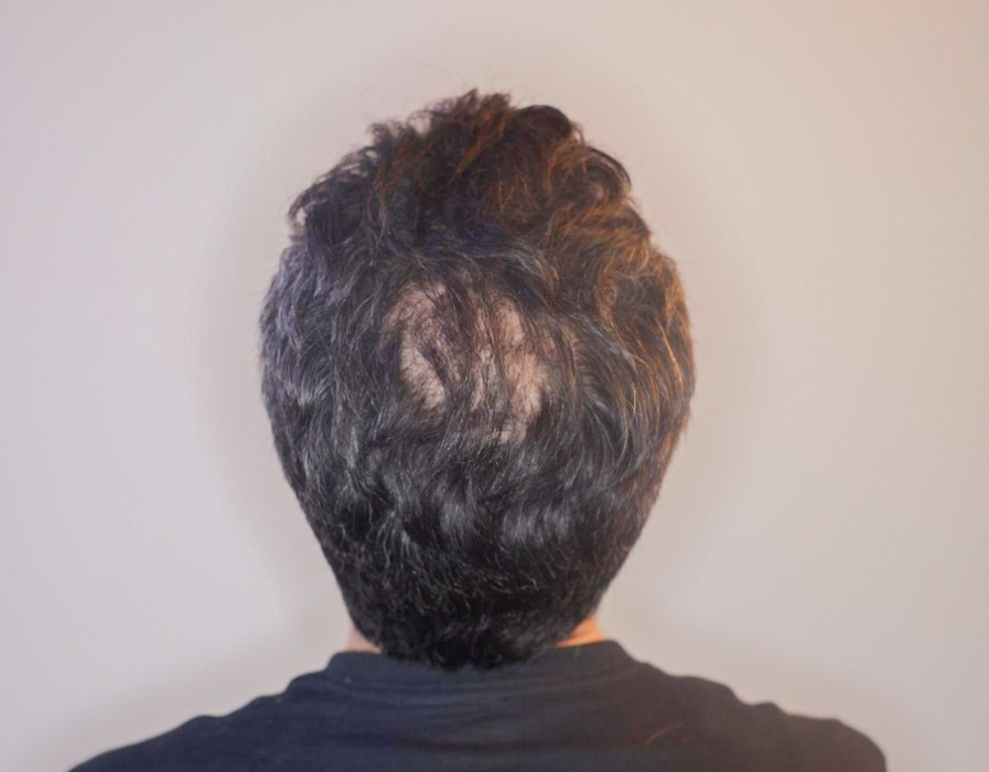 Click image for larger version

Name:	before 2.jpg
Views:	24
Size:	81.0 KB
ID:	539214