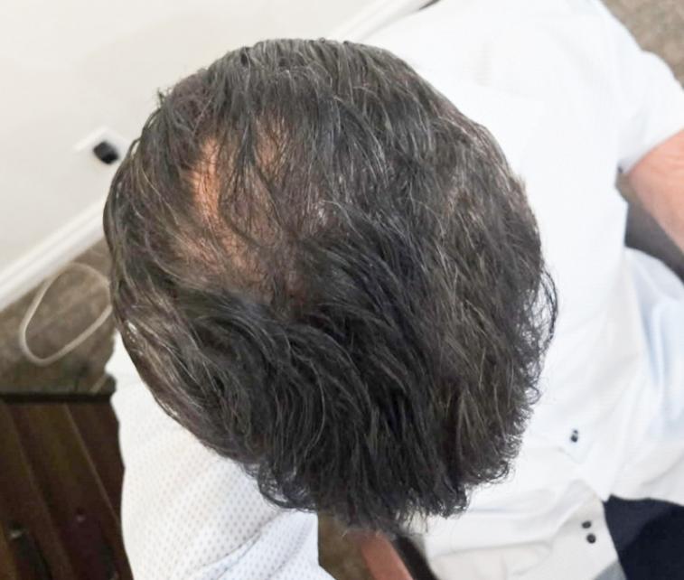 Click image for larger version

Name:	before 1.jpg
Views:	18
Size:	49.8 KB
ID:	539215