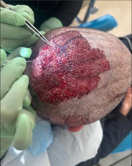 Click image for larger version

Name:	procedure day.jpg
Views:	18
Size:	87.4 KB
ID:	539216