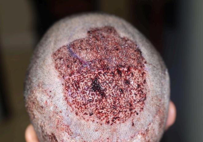 Click image for larger version

Name:	post op.jpg
Views:	18
Size:	45.0 KB
ID:	539217