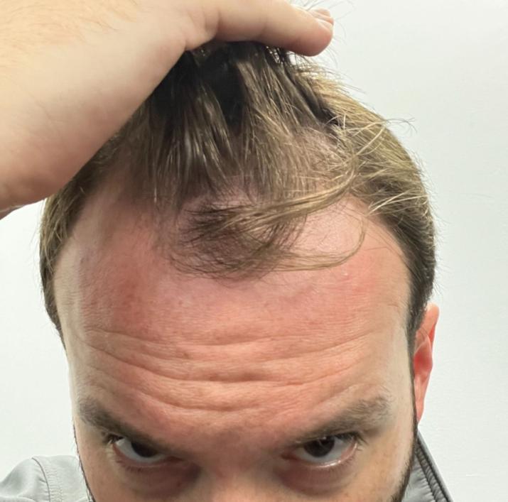 Click image for larger version

Name:	before.jpg
Views:	0
Size:	49.3 KB
ID:	539906