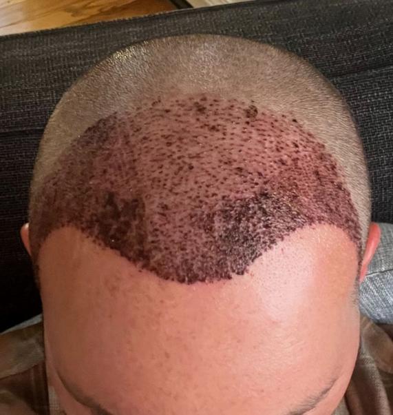 Click image for larger version

Name:	post op.jpg
Views:	0
Size:	49.8 KB
ID:	539908