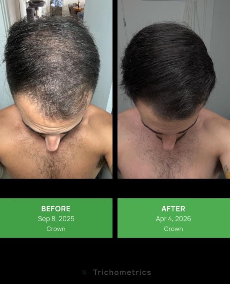 Click image for larger version

Name:	1.jpg
Views:	0
Size:	66.8 KB
ID:	540368