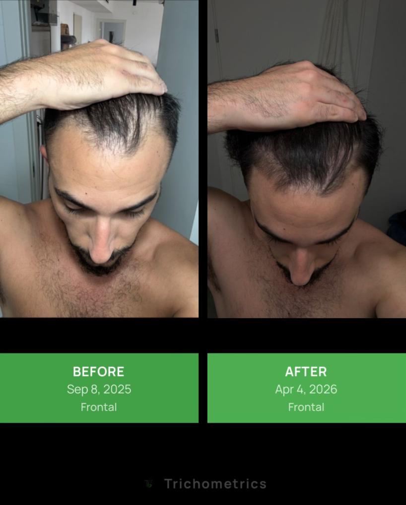 Click image for larger version

Name:	2.jpg
Views:	0
Size:	63.1 KB
ID:	540372