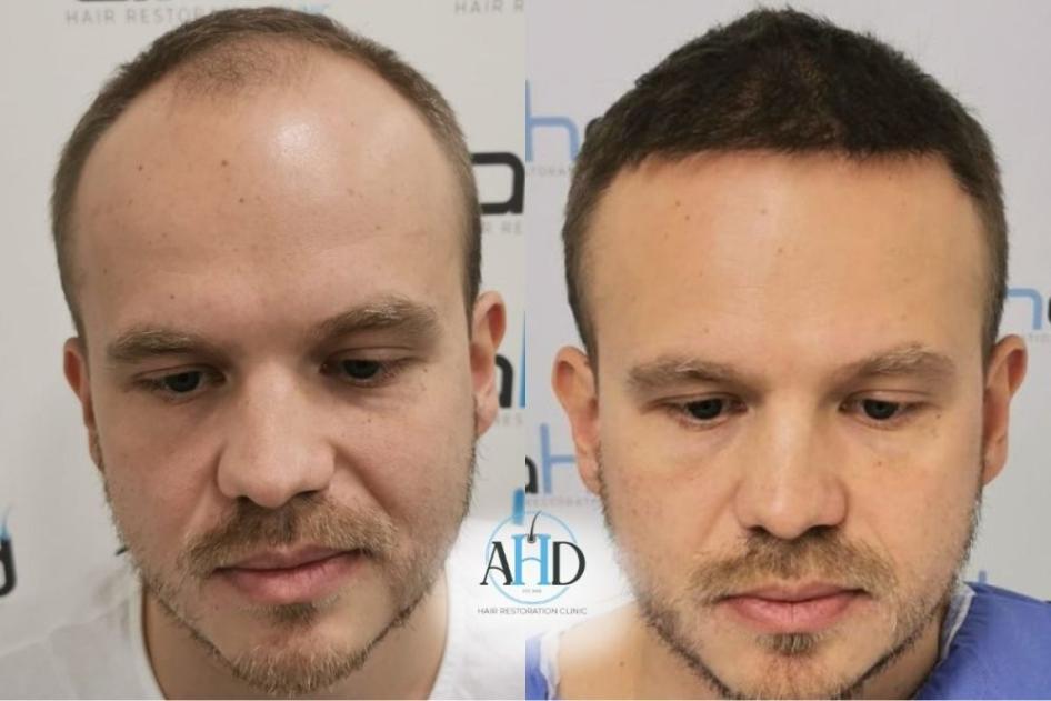 Click image for larger version  Name:	8.jpg Views:	0 Size:	52.4 KB ID:	540485