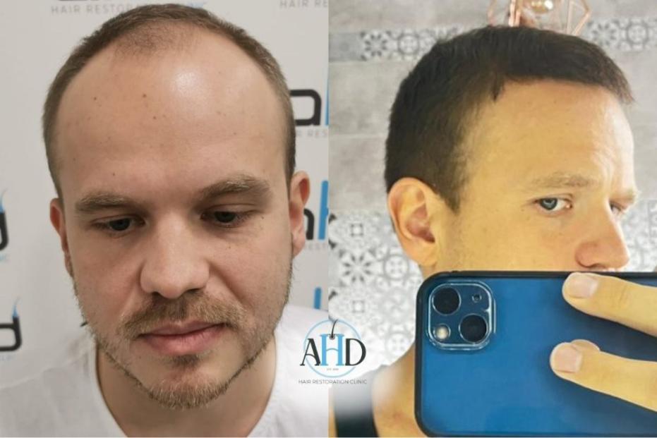 Click image for larger version  Name:	7.jpg Views:	0 Size:	52.7 KB ID:	540486