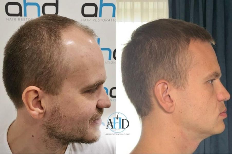 Click image for larger version

Name:	9.jpg
Views:	0
Size:	54.1 KB
ID:	540487